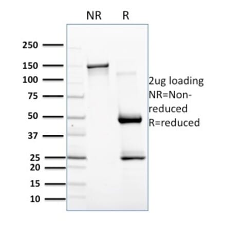 SDS-PAGE - Anti-BAFF Antibody [C257/1638] - BSA and Azide free (A251334) - Antibodies.com