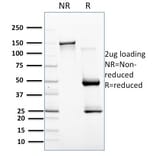 SDS-PAGE - Anti-BAFF Antibody [C257/1638] - BSA and Azide free (A251334) - Antibodies.com