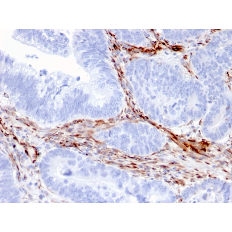 Immunohistochemistry - Anti-Nestin Antibody [NES/2911] - BSA and Azide free (A251336) - Antibodies.com