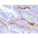 Immunohistochemistry - Anti-Nestin Antibody [NES/2911] - BSA and Azide free (A251336) - Antibodies.com