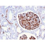 Immunohistochemistry - Anti-Nestin Antibody [NES/2911] - BSA and Azide free (A251336) - Antibodies.com