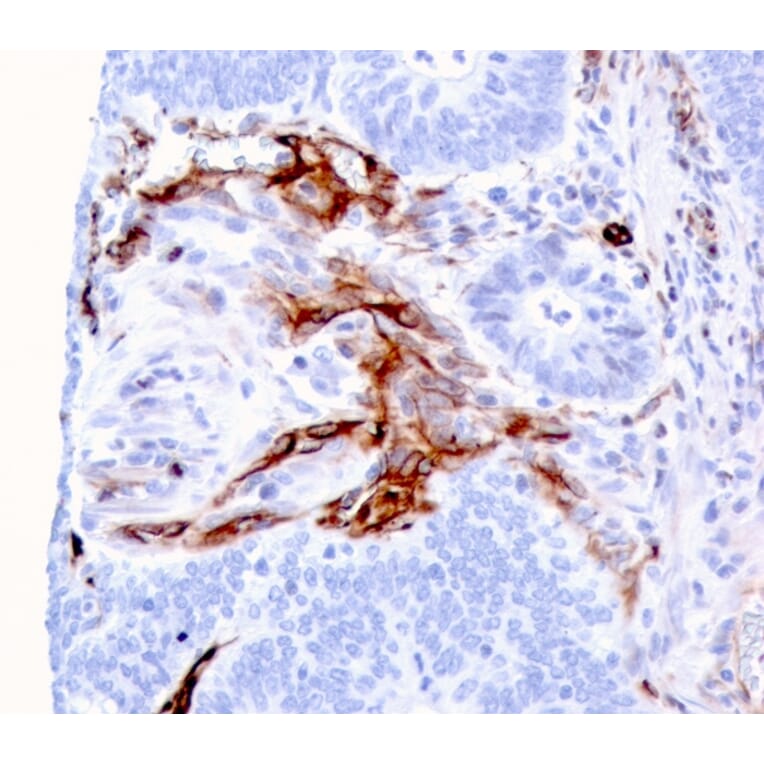 Immunohistochemistry - Anti-Nestin Antibody [NES/2911] - BSA and Azide free (A251335) - Antibodies.com