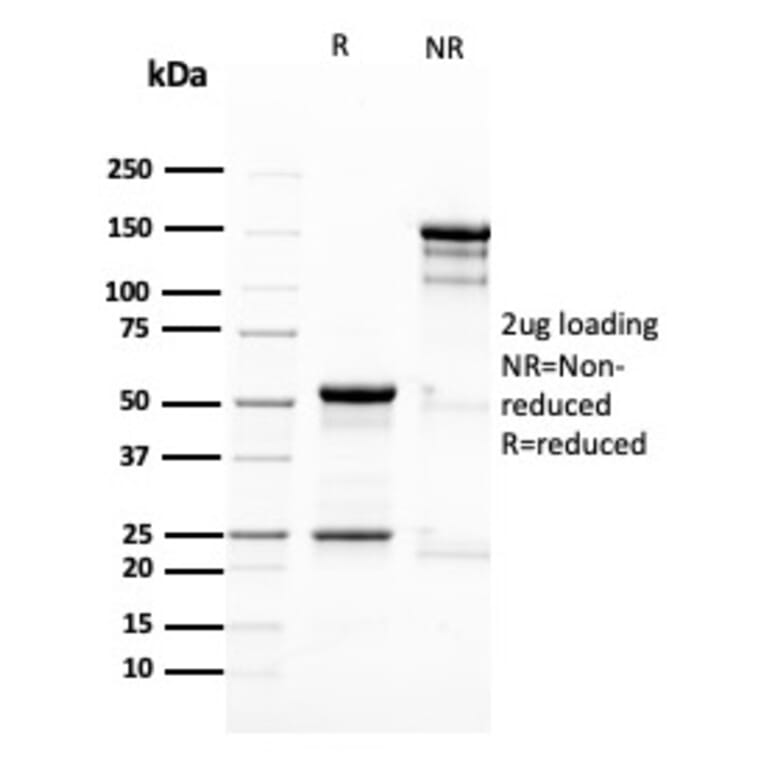 SDS-PAGE - Anti-Nestin Antibody [NES/2911] - BSA and Azide free (A251336) - Antibodies.com
