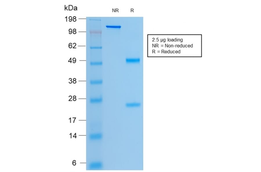 SDS-PAGE - Anti-CFTR Antibody [rCFTR/1342] - BSA and Azide free (A251343) - Antibodies.com
