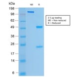 SDS-PAGE - Anti-CFTR Antibody [rCFTR/1342] - BSA and Azide free (A251343) - Antibodies.com