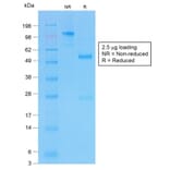 SDS-PAGE - Anti-CFTR Antibody [CFTR/1775R] - BSA and Azide free (A251344) - Antibodies.com
