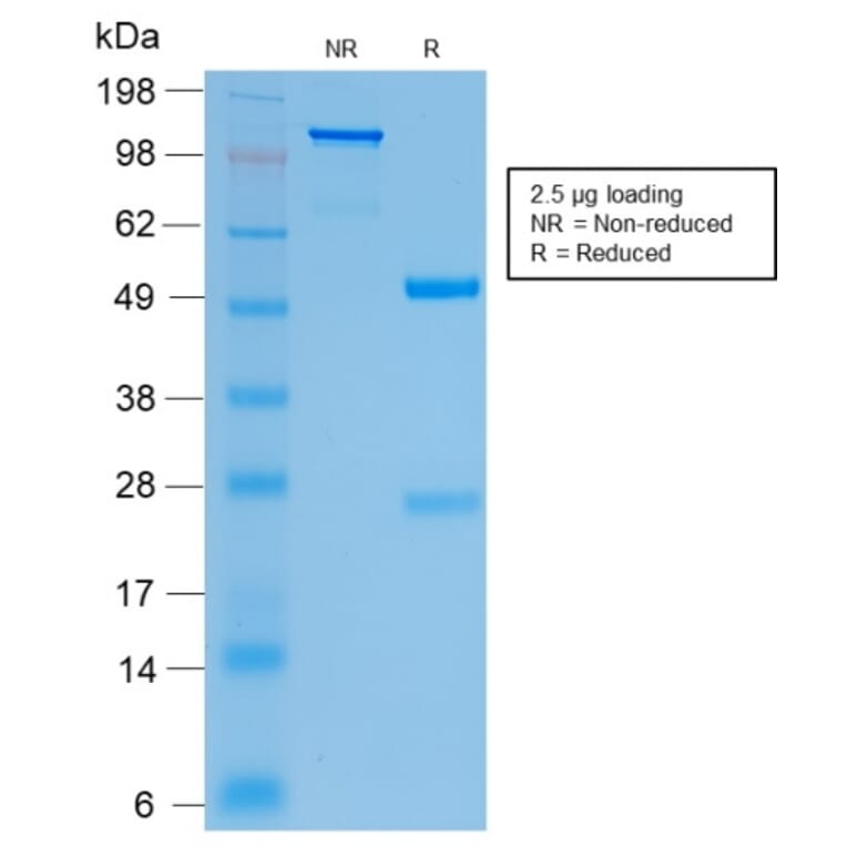 SDS-PAGE - Anti-CFTR Antibody [CFTR/2290R] - BSA and Azide free (A251345) - Antibodies.com