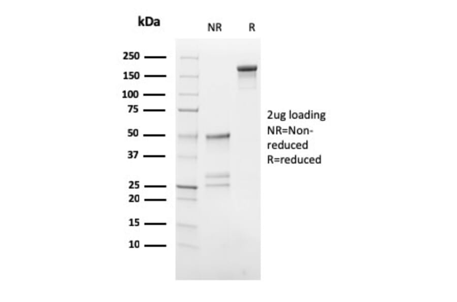 SDS-PAGE - Anti-HCG beta Antibody [HCGb/54] - BSA and Azide free (A251350) - Antibodies.com