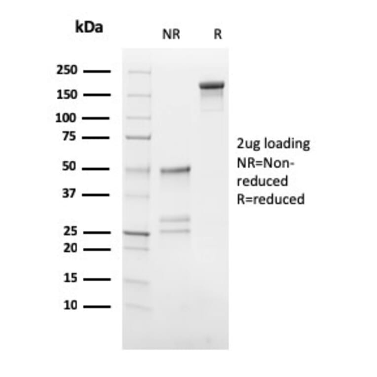 SDS-PAGE - Anti-HCG beta Antibody [HCGb/54] - BSA and Azide free (A251350) - Antibodies.com