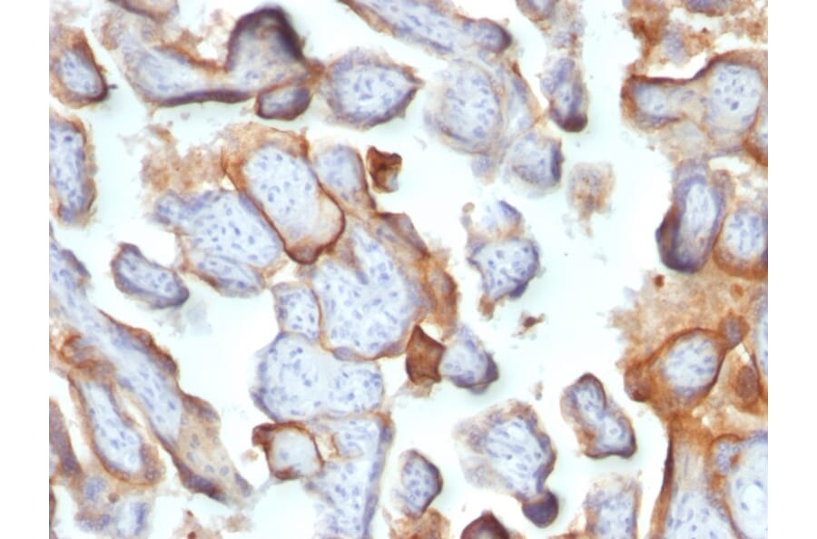 Immunohistochemistry - Anti-HCG beta Antibody [SPM105] - BSA and Azide free (A251350) - Antibodies.com