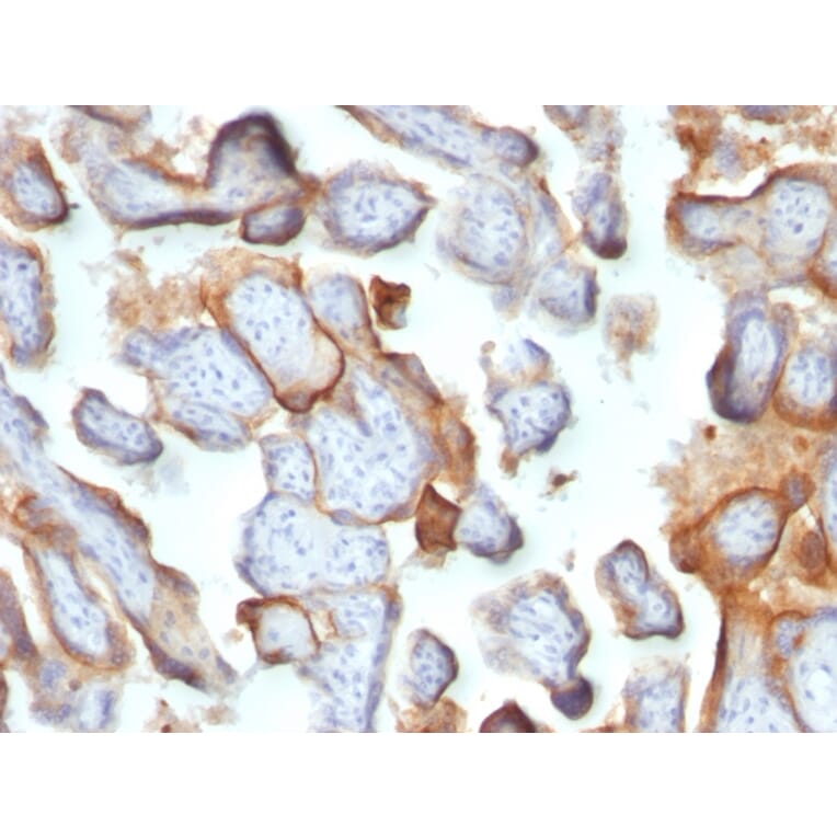 Immunohistochemistry - Anti-HCG beta Antibody [SPM105] - BSA and Azide free (A251350) - Antibodies.com