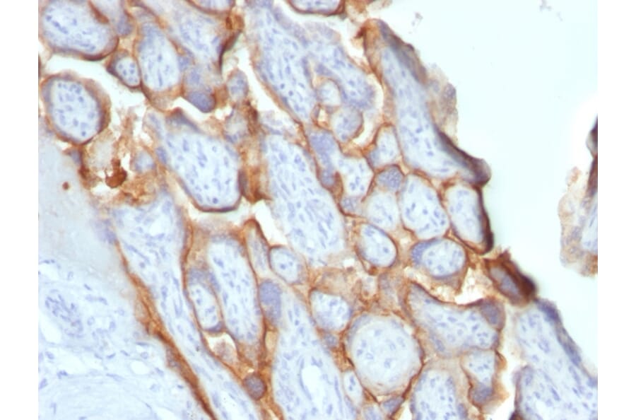 Immunohistochemistry - Anti-HCG beta Antibody [SPM529] - BSA and Azide free (A251352) - Antibodies.com