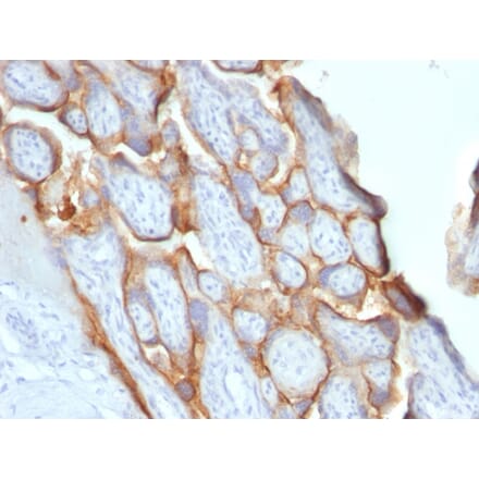 Immunohistochemistry - Anti-HCG beta Antibody [SPM529] - BSA and Azide free (A251352) - Antibodies.com