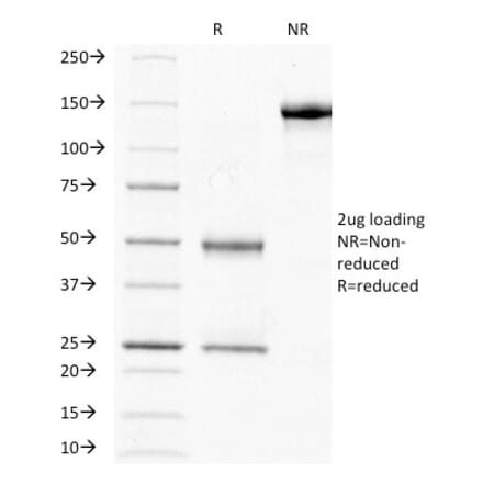 SDS-PAGE - Anti-HCG beta Antibody [HCGb/211] - BSA and Azide free (A251353) - Antibodies.com