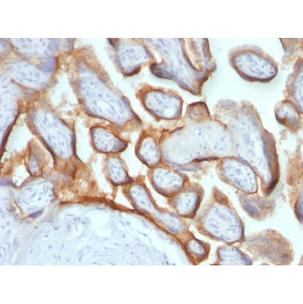 Immunohistochemistry - Anti-HCG beta Antibody [HCGb/54+ HCGb/459] - BSA and Azide free (A251354) - Antibodies.com