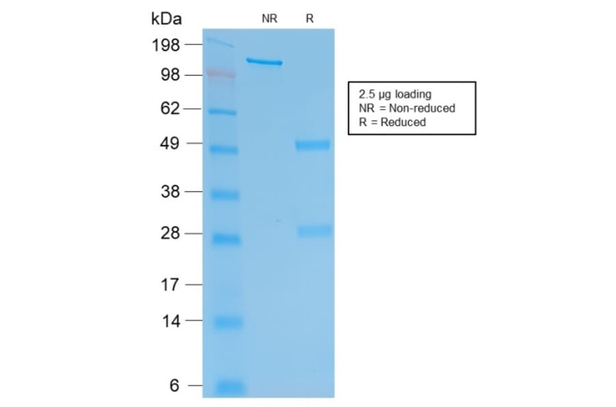 SDS-PAGE - Anti-HCG beta Antibody [rHCGb/54] - BSA and Azide free (A251356) - Antibodies.com