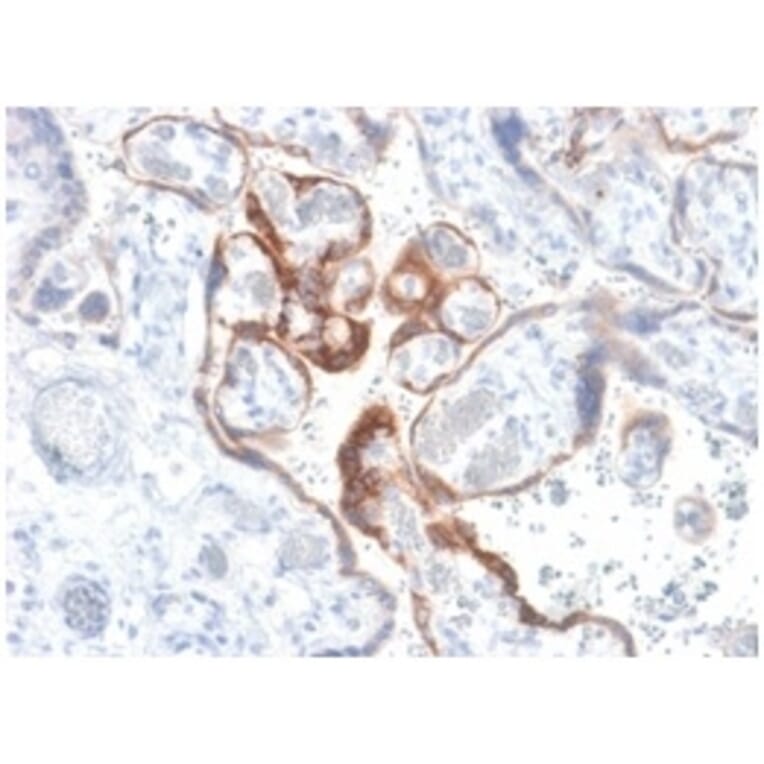 Immunohistochemistry - Anti-HCG beta Antibody [HCGb/1985R] - BSA and Azide free (A251356) - Antibodies.com