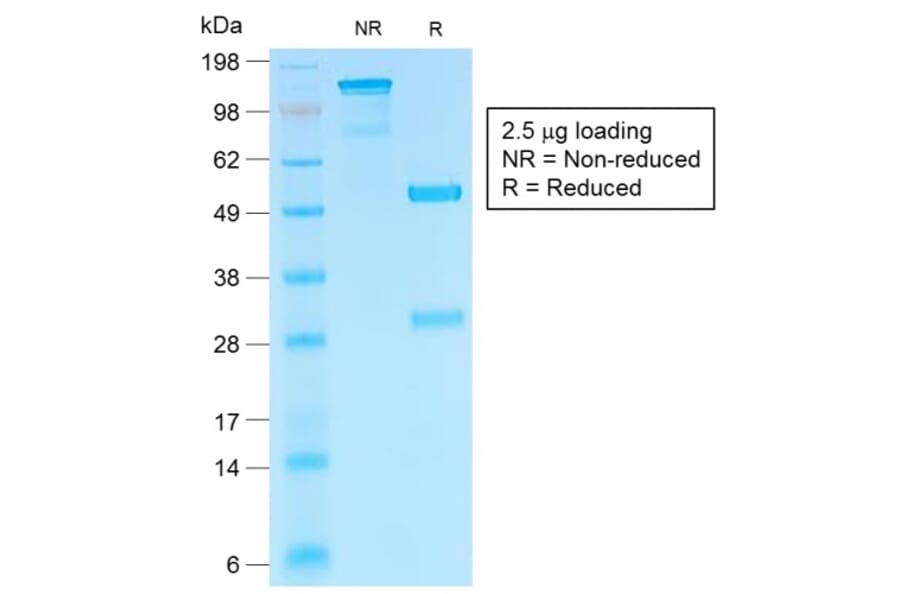 SDS-PAGE - Anti-HCG beta Antibody [HCGb/1985R] - BSA and Azide free (A251357) - Antibodies.com