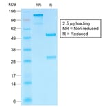 SDS-PAGE - Anti-HCG beta Antibody [HCGb/1985R] - BSA and Azide free (A251357) - Antibodies.com