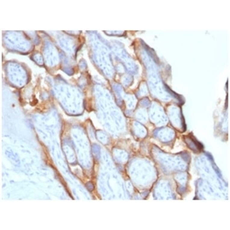 Immunohistochemistry - Anti-HCG beta Antibody [HCGb/1996R] - BSA and Azide free (A251357) - Antibodies.com
