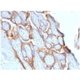 Immunohistochemistry - Anti-HCG beta Antibody [HCGb/1996R] - BSA and Azide free (A251357) - Antibodies.com