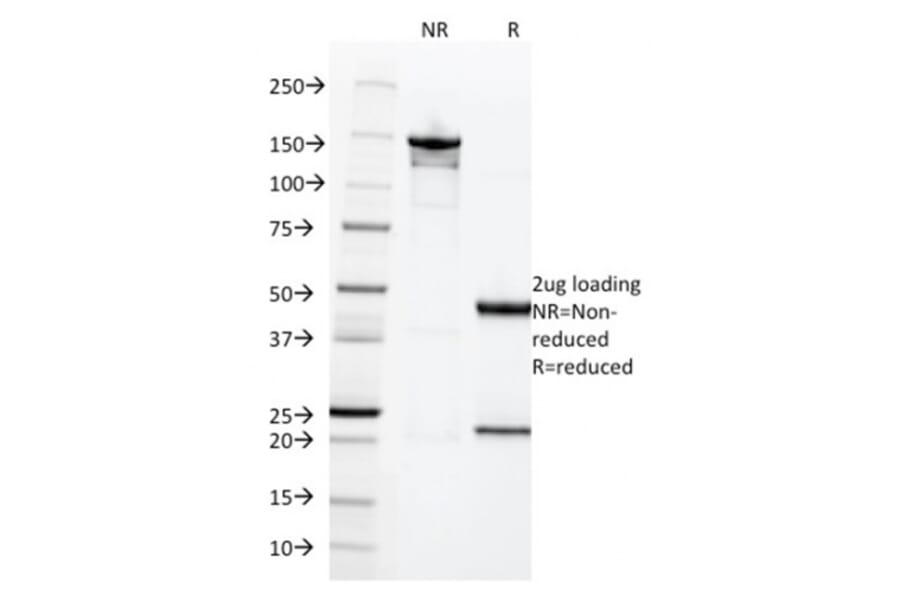 SDS-PAGE - Anti-HCG beta Antibody [HCGb/1996R] - BSA and Azide free (A251358) - Antibodies.com