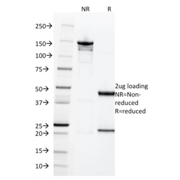 SDS-PAGE - Anti-HCG beta Antibody [HCGb/1996R] - BSA and Azide free (A251358) - Antibodies.com