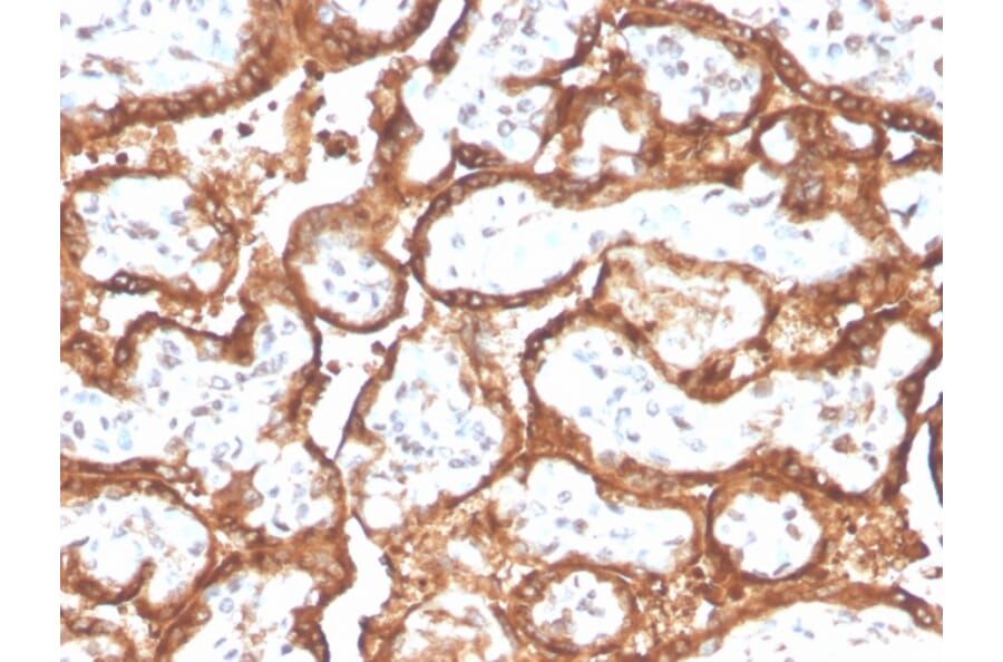 Immunohistochemistry - Anti-HCG beta Antibody [HCGb/2728R] - BSA and Azide free (A251359) - Antibodies.com