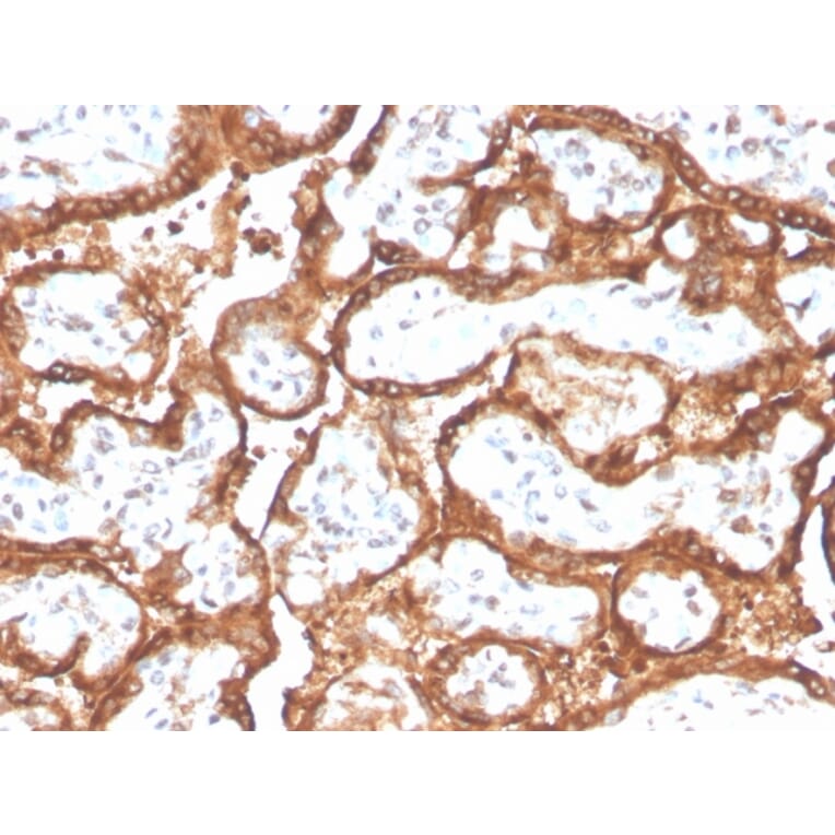 Immunohistochemistry - Anti-HCG beta Antibody [HCGb/2728R] - BSA and Azide free (A251359) - Antibodies.com