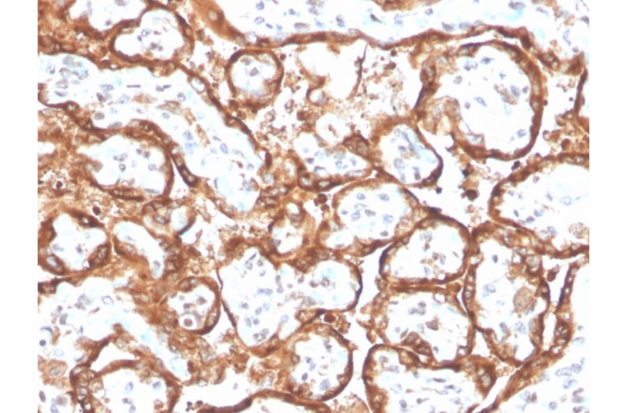 Immunohistochemistry - Anti-HCG beta Antibody [HCGb/2728R] - BSA and Azide free (A251358) - Antibodies.com