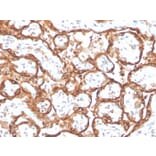 Immunohistochemistry - Anti-HCG beta Antibody [HCGb/2728R] - BSA and Azide free (A251358) - Antibodies.com