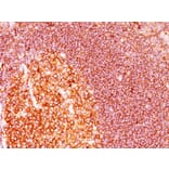 Immunohistochemistry - Anti-MALT1 Antibody [MT1/410] - BSA and Azide free (A251359) - Antibodies.com