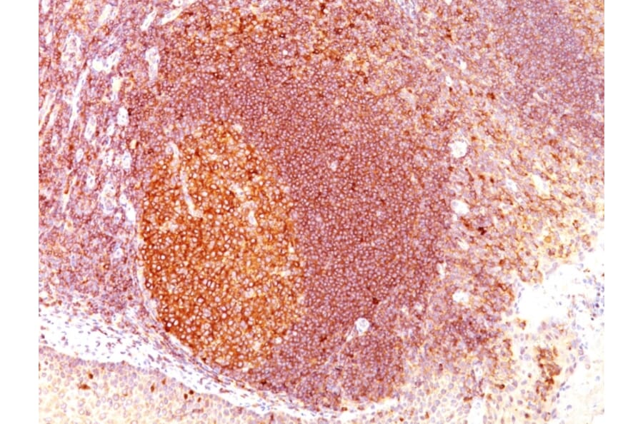 Immunohistochemistry - Anti-MALT1 Antibody [SPM578] - BSA and Azide free (A251361) - Antibodies.com