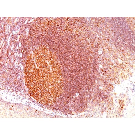 Immunohistochemistry - Anti-MALT1 Antibody [SPM578] - BSA and Azide free (A251361) - Antibodies.com