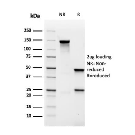 SDS-PAGE - Anti-MALT1 Antibody [rMT1/410] - BSA and Azide free (A251363) - Antibodies.com