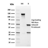 SDS-PAGE - Anti-MALT1 Antibody [rMT1/410] - BSA and Azide free (A251363) - Antibodies.com