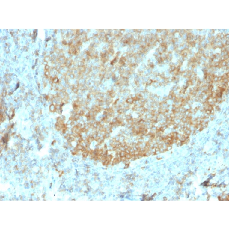 Immunohistochemistry - Anti-MALT1 Antibody [rMT1/410] - BSA and Azide free (A251362) - Antibodies.com