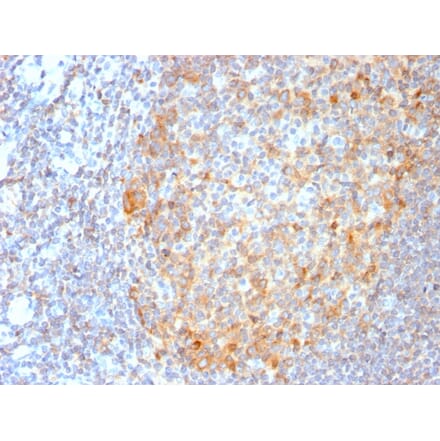 Immunohistochemistry - Anti-MALT1 Antibody [MT1/3159R] - BSA and Azide free (A251363) - Antibodies.com