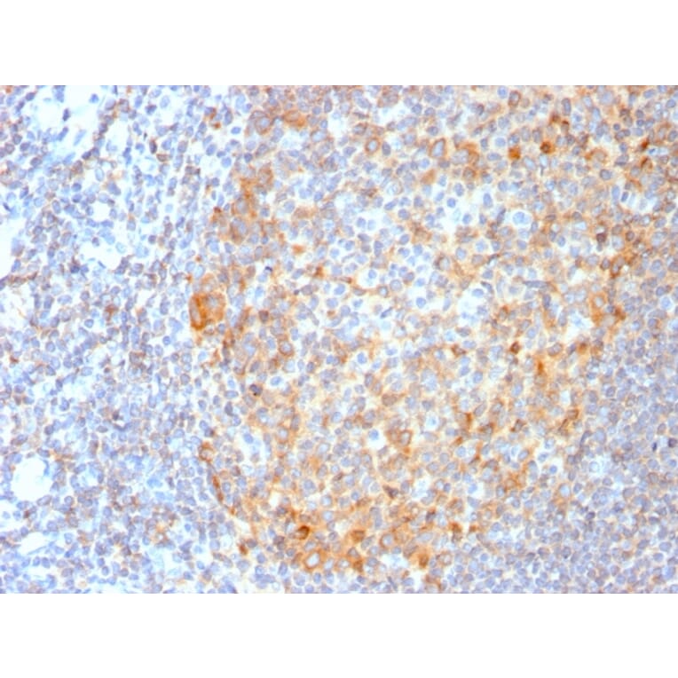 Immunohistochemistry - Anti-MALT1 Antibody [MT1/3159R] - BSA and Azide free (A251363) - Antibodies.com