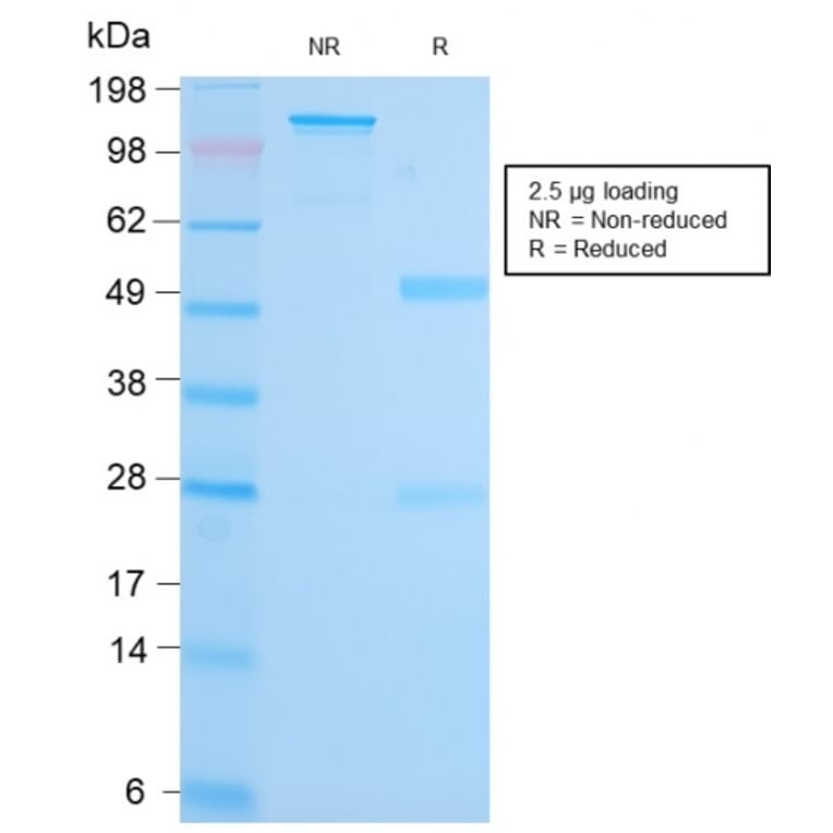 SDS-PAGE - Anti-MALT1 Antibody [MT1/3159R] - BSA and Azide free (A251364) - Antibodies.com