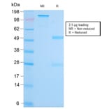 SDS-PAGE - Anti-MALT1 Antibody [MT1/3159R] - BSA and Azide free (A251364) - Antibodies.com