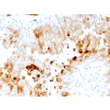 Immunohistochemistry - Anti-Uroplakin 1A Antibody [UPK1A/2921] - BSA and Azide free (A251365) - Antibodies.com