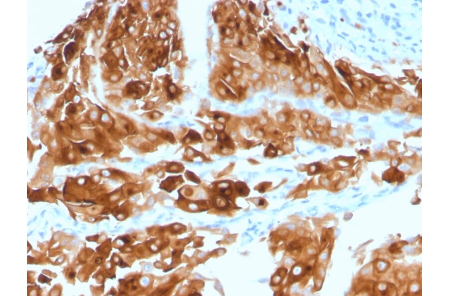 Immunohistochemistry - Anti-Uroplakin 1A Antibody [UPK1A/2921] - BSA and Azide free (A251365) - Antibodies.com