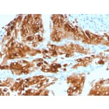 Immunohistochemistry - Anti-Uroplakin 1A Antibody [UPK1A/2921] - BSA and Azide free (A251365) - Antibodies.com