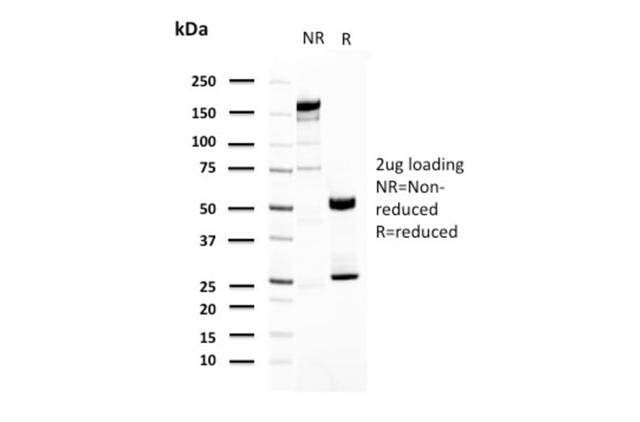 SDS-PAGE - Anti-Uroplakin 1A Antibody [UPK1A/2921] - BSA and Azide free (A251365) - Antibodies.com