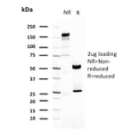 SDS-PAGE - Anti-Uroplakin 1A Antibody [UPK1A/2921] - BSA and Azide free (A251365) - Antibodies.com