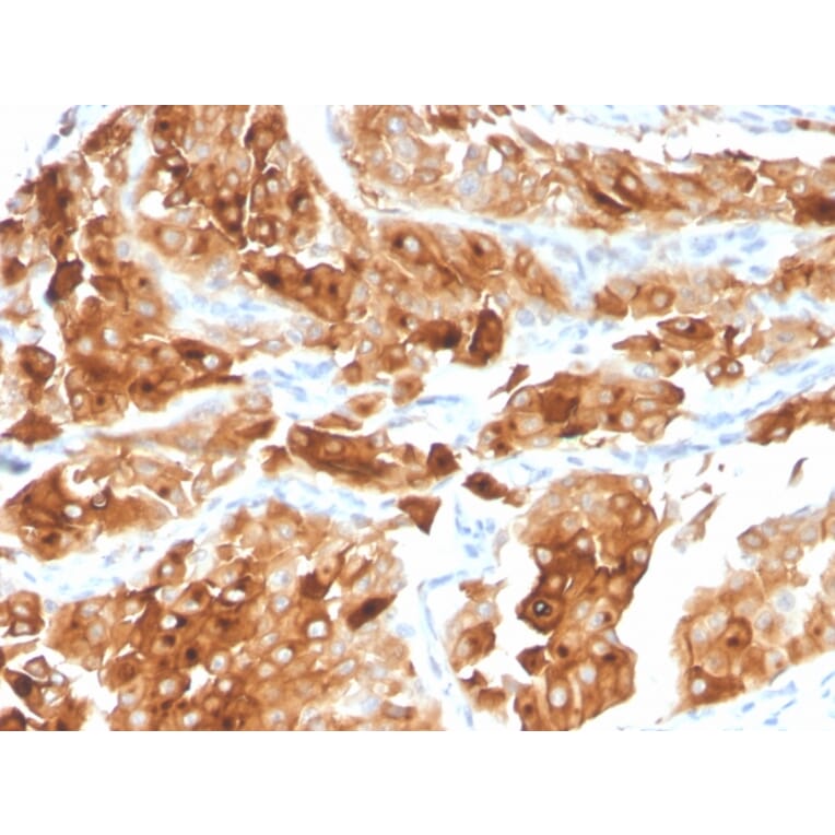 Immunohistochemistry - Anti-Uroplakin 1A Antibody [UPK1A/2922] - BSA and Azide free (A251366) - Antibodies.com