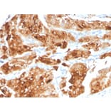 Immunohistochemistry - Anti-Uroplakin 1A Antibody [UPK1A/2922] - BSA and Azide free (A251366) - Antibodies.com