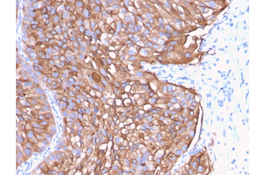Immunohistochemistry - Anti-Uroplakin 1A Antibody [UPK1A/2922] - BSA and Azide free (A251366) - Antibodies.com