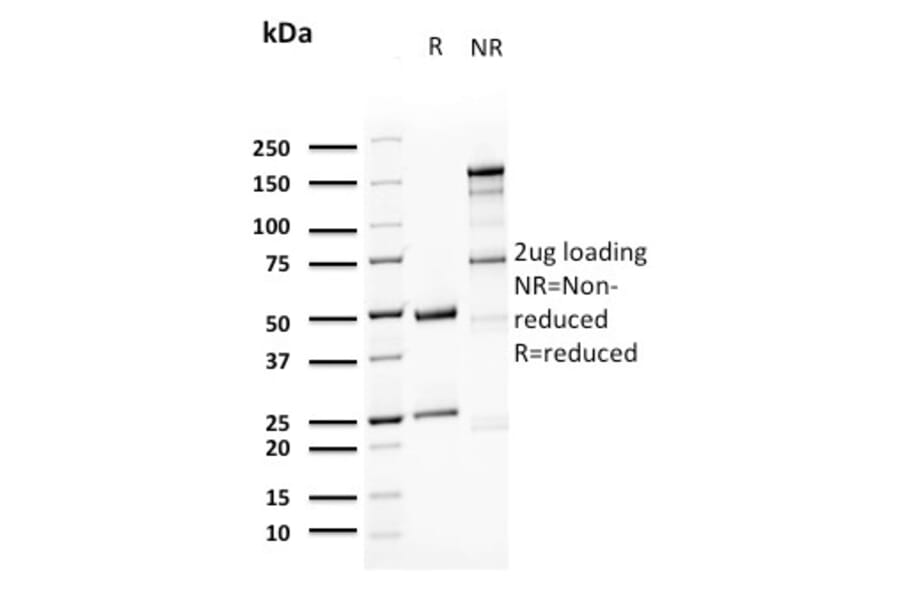 SDS-PAGE - Anti-Uroplakin 1A Antibody [UPK1A/2923] - BSA and Azide free (A251367) - Antibodies.com